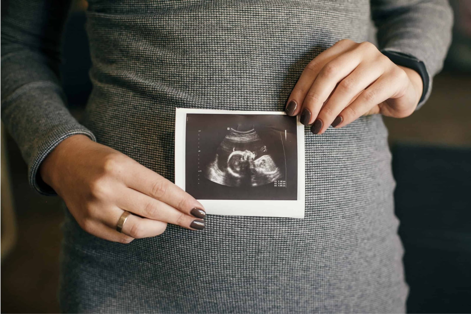 Expectant mother holding an ultrasound image